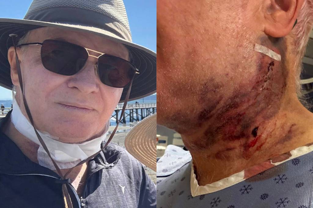 ‘Eye-opener’: White Rock senior turns focus to stroke awareness