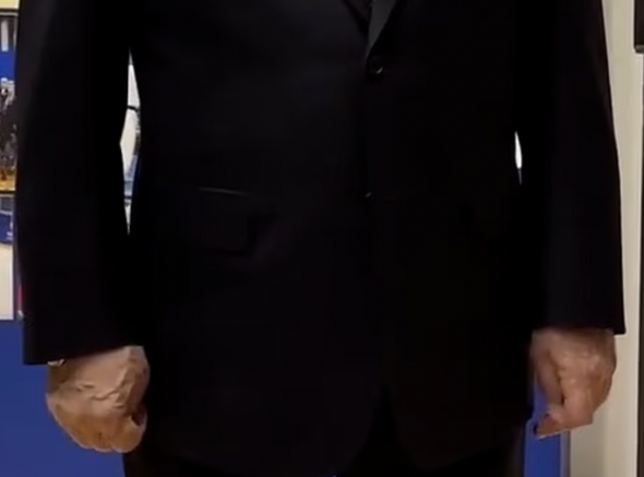 Putin health fears as swollen veins look 'extremely painful'